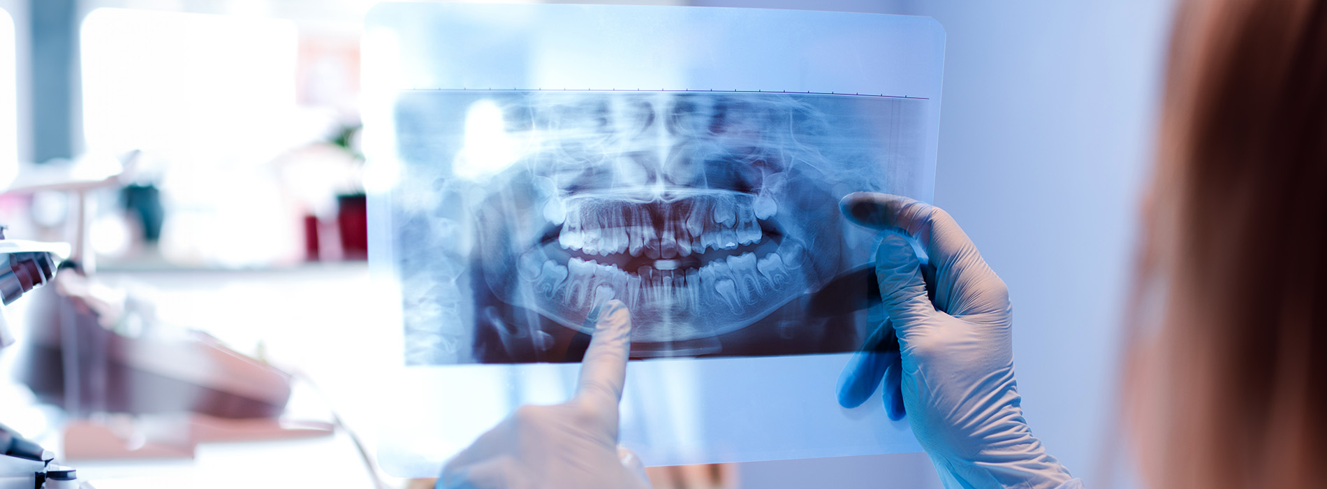 A person is holding a transparent sheet with an X-ray image of a human head, possibly for dental or medical examination.